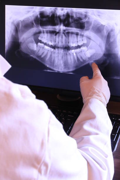 Best Emergency Treatment for Dental Infections or Abscesses in Pleasantville, NY