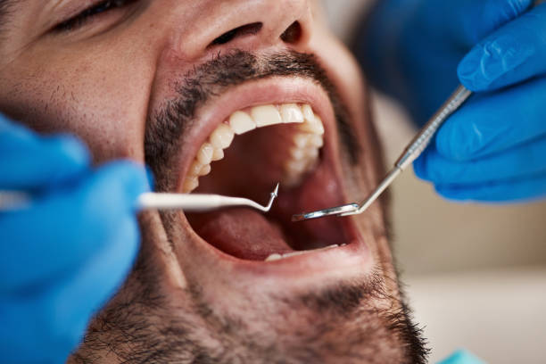 Best Emergency Denture Repair in Pleasantville, NY